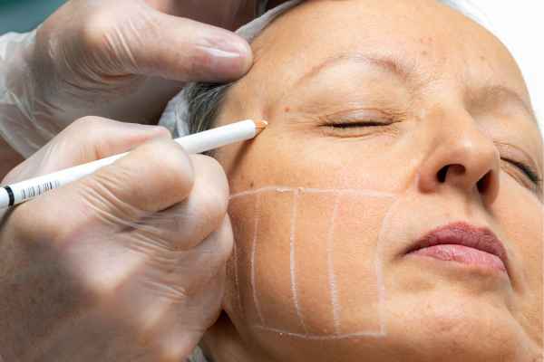 CryoPen: 5 Skin Concerns It May Be Used to Treat 4 What should you ask before having CryoPen treatment Grays?