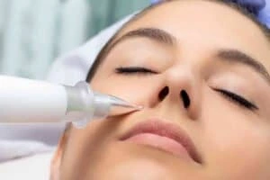 Best Actinic Keratoses Removal 3 Actinic keratoses Grays solutions - book in today!